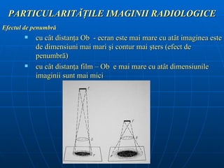PARTICULARITĂŢILE IMAGINII RADIOLOGICE
Efectul de penumbră
          cu cât distanţa Ob - ecran este mai mare cu atât imaginea este
           de dimensiuni mai mari şi contur mai şters (efect de
           penumbră)
          cu cât distanţa film – Ob e mai mare cu atât dimensiunile
           imaginii sunt mai mici
 