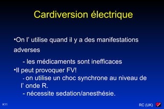 RC (UK)K11
Cardiversion électrique
•On l’ utilise quand il y a des manifestations
adverses
- les médicaments sont inefficaces
•Il peut provoquer FV!
- on utilise un choc synchrone au niveau de
l’ onde R.
- nécessite sedation/anesthésie.
 