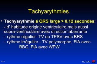 RC (UK)K23
Tachyarythmies
• Tachyarythmie á QRS large > 0,12 secondes:
- d’ habitude origine ventriculaire mais aussi
supra-ventriculaire avec direction aberrante
- rythme régulier- TV ou TPSV avec BRS
- rythme irrégulier - TV polymorphe, FiA avec
BBG, FiA avec WPW
 