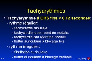 RC (UK)K24
Tachyarythmies
• Tachyarythmie á QRS fins < 0,12 secondes:
- rythme régulier:
- tachycardie sinusale,
- tachycardie sans réentrée nodale,
- tachycardie par réentrée nodale,
- flutter auriculaire á blocage fixe
- rythme irrégulier:
- fibrillation auriculaire,
- flutter auriculaire á blocage variable
 