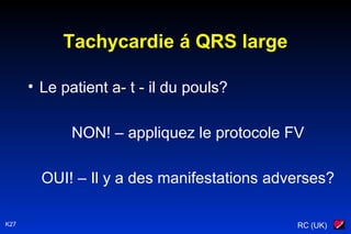 RC (UK)K27
Tachycardie á QRS large
• Le patient a- t - il du pouls?
NON! – appliquez le protocole FV
OUI! – Il y a des manifestations adverses?
 