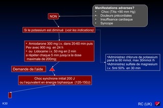 RC (UK)K30
Manifestations adverses?
• Choc (TAs <90 mm Hg)
• Douleurs précordiales
• Insuffisance cardiaque
• Syncope
NON
• Amiodarone 300 mg i.v. dans 20-60 min puis
Pev avec 900 mg en 24 h
• ou Lidocaine i.v. 50 mg en 2 min
a répéter chaque 5 min jusqu’a la dose
maximale de 200mg;
Choc synchrone initial 200 J
ou l’equivalent en énergie biphasique (120-150J)
Demande de l’aide
Si le potassium est diminué (voir les indications)
•Administrez chlorure de potassium
pană la 60 mmol, max 30mmol /h
•Administrez sulfate de magnesium
i.v. 5ml 50% en 30 min
 