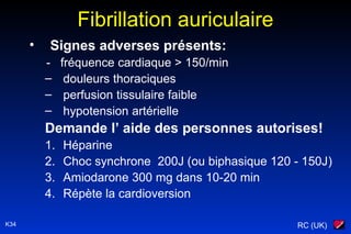 RC (UK)K34
Fibrillation auriculaire
• Signes adverses présents:
- fréquence cardiaque > 150/min
– douleurs thoraciques
– perfusion tissulaire faible
– hypotension artérielle
Demande l’ aide des personnes autorises!
1. Héparine
2. Choc synchrone 200J (ou biphasique 120 - 150J)
3. Amiodarone 300 mg dans 10-20 min
4. Répète la cardioversion
 