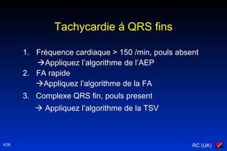 RC (UK)K38
Tachycardie á QRS fins
1. Fréquence cardiaque > 150 /min, pouls absent
Appliquez l’algorithme de l’AEP
2. FA rapide
Appliquez l’algorithme de la FA
3. Complexe QRS fin, pouls present
 Appliquez l’algorithme de la TSV
 