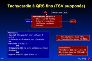 RC (UK)K42
Demande de l’aide
Manifestations adverses?
• Choc (TAs <90 mm Hg)
• Ischémie myocardique
• Insuffisance cardiaque
• Syncope
OUINON
Alternatives:
•Esmolol: 40 mg après 1 min + perfusion 4
mg /min
(a répéter i.v. si nécessaire, max 12 mg /min)
OU
•Verapamil 5-10 mg i.v.
OU
•Amiodarone: 300 mg en1h, a répéter une fois si
nécessaire
OU
•Digoxin: max 500 µg en 30 min x2
Choc synchrone initial 100 J
ou l’équivalent biphasique (70-120J)
Si nécessaire:
•Amiodarone 300 mg i.v. dans 10-
20 min puis pev avec 900 mg/24 h
• choc a répéter
Tachycardie á QRS fins (TSV supposée)
 