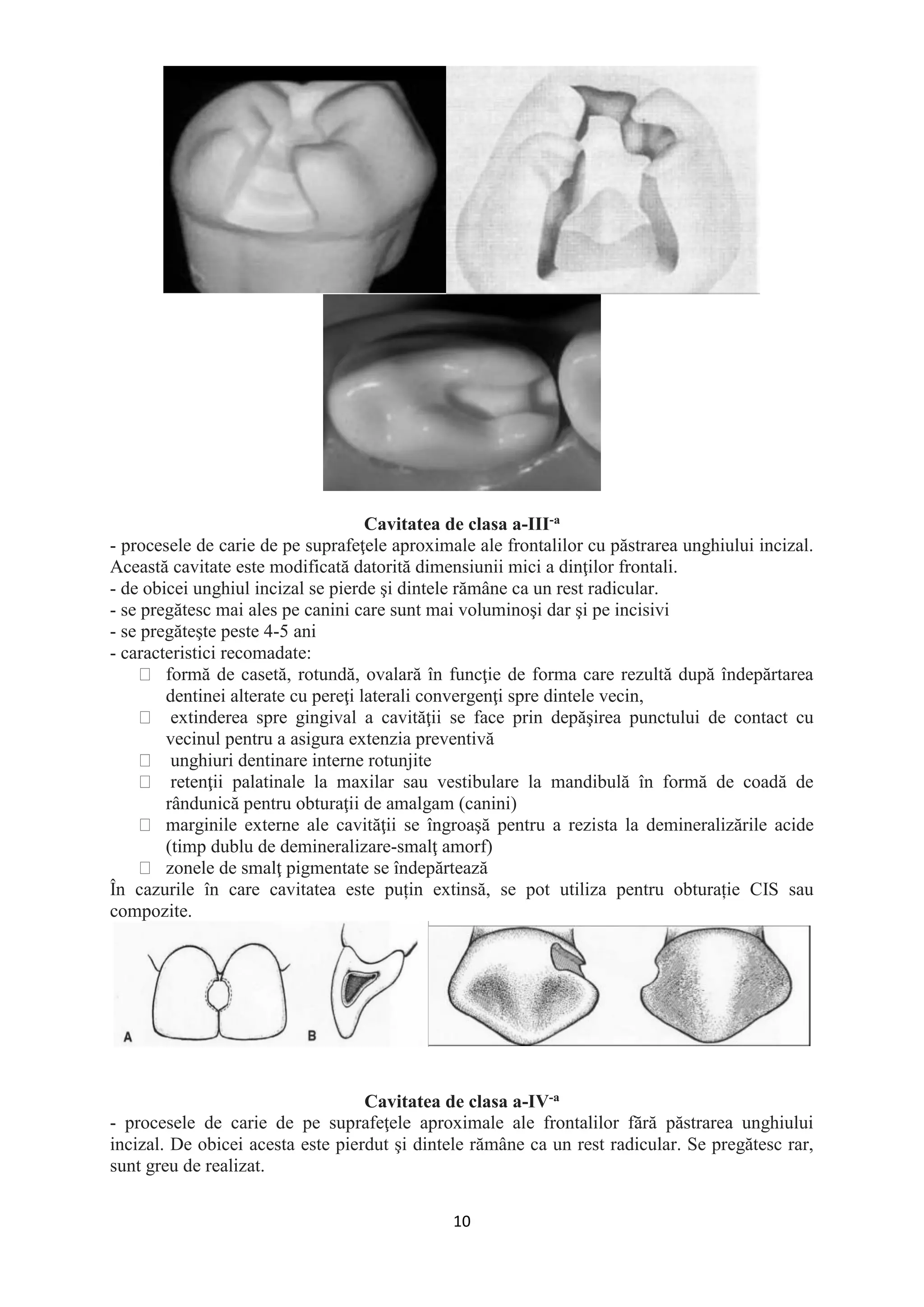 10
Cavitatea de clasa a-III-a
- procesele de carie de pe suprafeţele aproximale ale frontalilor cu păstrarea unghiului incizal.
Această cavitate este modificată datorită dimensiunii mici a dinţilor frontali.
- de obicei unghiul incizal se pierde şi dintele rămâne ca un rest radicular.
- se pregătesc mai ales pe canini care sunt mai voluminoşi dar şi pe incisivi
- se pregăteşte peste 4-5 ani
- caracteristici recomadate:
formă de casetă, rotundă, ovalară în funcţie de forma care rezultă după îndepărtarea
dentinei alterate cu pereţi laterali convergenţi spre dintele vecin,
extinderea spre gingival a cavităţii se face prin depăşirea punctului de contact cu
vecinul pentru a asigura extenzia preventivă
unghiuri dentinare interne rotunjite
retenţii palatinale la maxilar sau vestibulare la mandibulă în formă de coadă de
rândunică pentru obturaţii de amalgam (canini)
marginile externe ale cavităţii se îngroaşă pentru a rezista la demineralizările acide
(timp dublu de demineralizare-smalţ amorf)
zonele de smalţ pigmentate se îndepărtează
În cazurile în care cavitatea este puțin extinsă, se pot utiliza pentru obturație CIS sau
compozite.
Cavitatea de clasa a-IV-a
- procesele de carie de pe suprafeţele aproximale ale frontalilor fără păstrarea unghiului
incizal. De obicei acesta este pierdut şi dintele rămâne ca un rest radicular. Se pregătesc rar,
sunt greu de realizat.
 