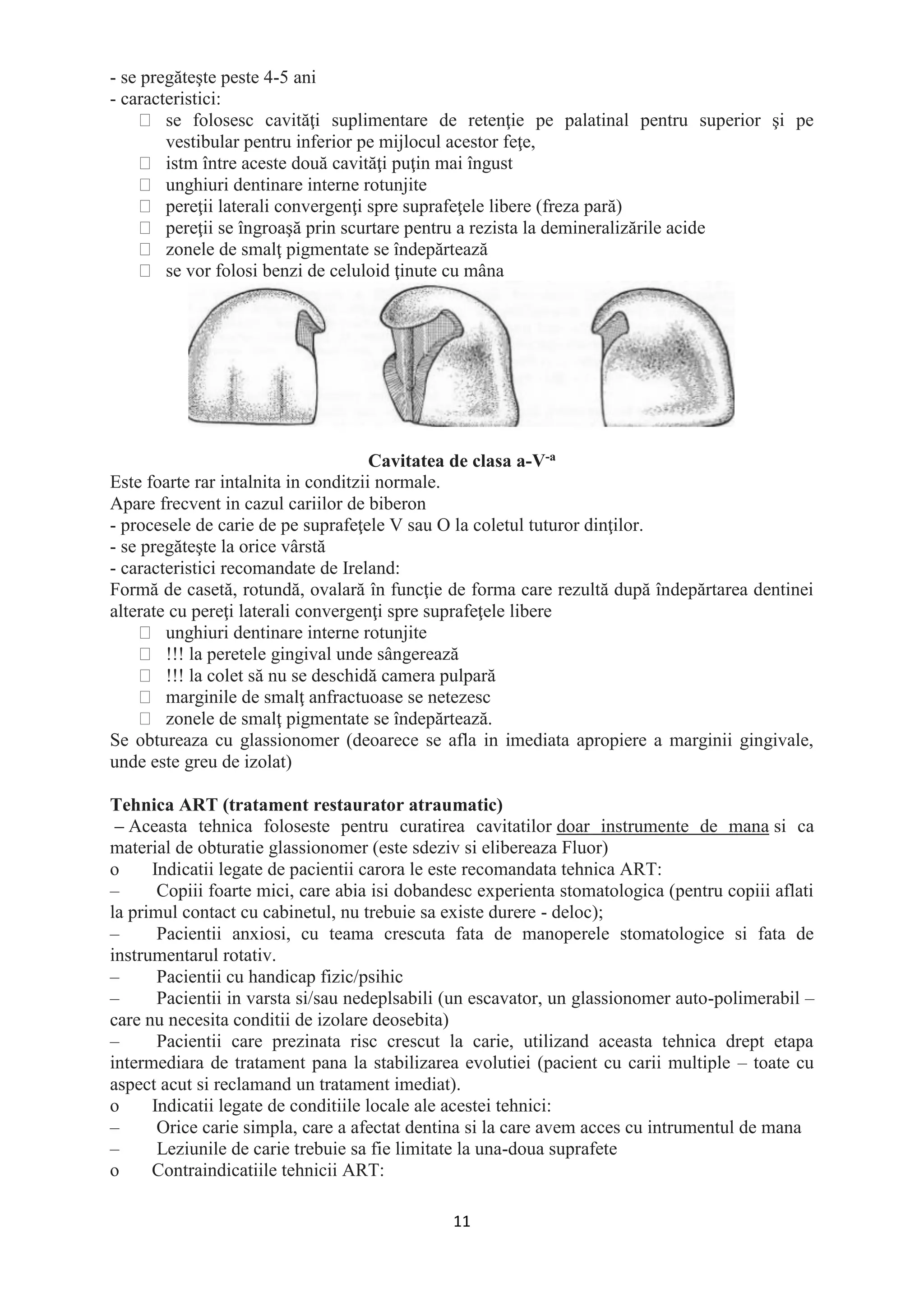 11
- se pregăteşte peste 4-5 ani
- caracteristici:
se folosesc cavităţi suplimentare de retenţie pe palatinal pentru superior şi pe
vestibular pentru inferior pe mijlocul acestor feţe,
istm între aceste două cavităţi puţin mai îngust
unghiuri dentinare interne rotunjite
pereţii laterali convergenţi spre suprafeţele libere (freza pară)
pereţii se îngroaşă prin scurtare pentru a rezista la demineralizările acide
zonele de smalţ pigmentate se îndepărtează
se vor folosi benzi de celuloid ţinute cu mâna
Cavitatea de clasa a-V-a
Este foarte rar intalnita in conditzii normale.
Apare frecvent in cazul cariilor de biberon
- procesele de carie de pe suprafeţele V sau O la coletul tuturor dinţilor.
- se pregăteşte la orice vârstă
- caracteristici recomandate de Ireland:
Formă de casetă, rotundă, ovalară în funcţie de forma care rezultă după îndepărtarea dentinei
alterate cu pereţi laterali convergenţi spre suprafeţele libere
unghiuri dentinare interne rotunjite
!!! la peretele gingival unde sângerează
!!! la colet să nu se deschidă camera pulpară
marginile de smalţ anfractuoase se netezesc
zonele de smalţ pigmentate se îndepărtează.
Se obtureaza cu glassionomer (deoarece se afla in imediata apropiere a marginii gingivale,
unde este greu de izolat)
Tehnica ART (tratament restaurator atraumatic)
– Aceasta tehnica foloseste pentru curatirea cavitatilor doar instrumente de mana si ca
material de obturatie glassionomer (este sdeziv si elibereaza Fluor)
o Indicatii legate de pacientii carora le este recomandata tehnica ART:
– Copiii foarte mici, care abia isi dobandesc experienta stomatologica (pentru copiii aflati
la primul contact cu cabinetul, nu trebuie sa existe durere - deloc);
– Pacientii anxiosi, cu teama crescuta fata de manoperele stomatologice si fata de
instrumentarul rotativ.
– Pacientii cu handicap fizic/psihic
– Pacientii in varsta si/sau nedeplsabili (un escavator, un glassionomer auto-polimerabil –
care nu necesita conditii de izolare deosebita)
– Pacientii care prezinata risc crescut la carie, utilizand aceasta tehnica drept etapa
intermediara de tratament pana la stabilizarea evolutiei (pacient cu carii multiple – toate cu
aspect acut si reclamand un tratament imediat).
o Indicatii legate de conditiile locale ale acestei tehnici:
– Orice carie simpla, care a afectat dentina si la care avem acces cu intrumentul de mana
– Leziunile de carie trebuie sa fie limitate la una-doua suprafete
o Contraindicatiile tehnicii ART:
 