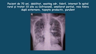 Pacient de 70 ani, debilitat, wasting sdr, febril, internat în spital
rural și tratat 10 zile cu Cefriaxonă, ameliorat parțial, reia febra
după externare, tușește productiv, purulent
 