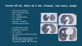 Pacient 65 ani, febra de 2 zile, frisoane, tuse seaca, mialgii
• DZ tip II, controlat
• SO2 = 93% (fara O2)
• FR = 25/min
• TA = 130/80 mmHg
• AV = 88/min
• Constient, orientat
• Pierdere gust & miros
• Covid19 forma medie
• Prognostic rezervat:
• DZ + varsta
• La 7-10 zile de la debut se poate
agrava!
• Monitorizare atenta! (clinica, TA,
AV, FR, SO2, EAB, Ddimeri,
troponina, proBNP, CRP, feritina)
 