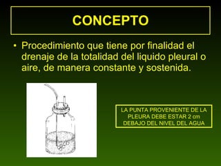 CONCEPTO Procedimiento que tiene por finalidad el drenaje de la totalidad del liquido pleural o aire, de manera constante y sostenida. LA PUNTA PROVENIENTE DE LA PLEURA DEBE ESTAR 2 cm DEBAJO DEL NIVEL DEL AGUA 