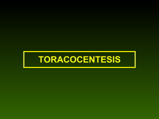 TORACOCENTESIS 