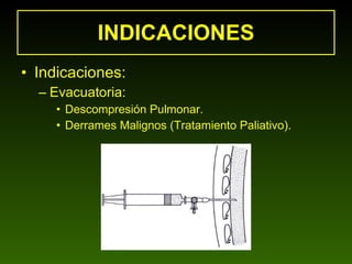 INDICACIONES Indicaciones: Evacuatoria: Descompresión Pulmonar. Derrames Malignos (Tratamiento Paliativo). 