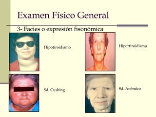 Examen Físico General
3- Facies o expresión fisonómica
Hipotiroidismo
Sd. Cushing
Hipertiroidismo
Sd. Anémico
 