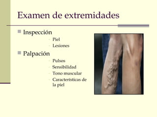 Examen de extremidades
 Inspección
- Piel
- Lesiones
 Palpación
- Pulsos
- Sensibilidad
- Tono muscular
- Características de
la piel
 