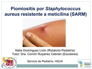 Piomiositis por Staphylococcus
aureus resistente a meticilina (SARM)
Nalia Domínguez Lirón (Rotatorio Pediatría)
Tutor: Dra. Conchi Ruipérez Cebrián (Escolares)
Servicio de Pediatría, HGUA
 