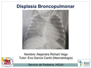 Displasia Broncopulmonar
Nombre: Alejandra Richart Vega
Tutor: Eva García Cantó (Neonatología)
Servicio de Pediatría, HGUA
 