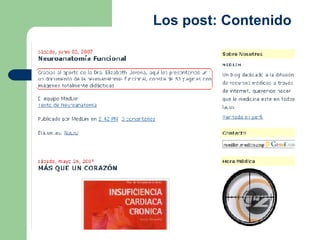 Los post: Contenido  