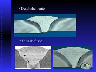 Desalinhamento  Falta de fusão 