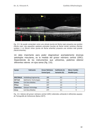Dr. G. Vincent P. Cedilás Oftalmología
10
Fig. 2.5. Se puede comprobar como una vénula (punta de flecha roja) proyecta una sombra
(flecha roja), dos pequeños capilares arteriales (puntas de flecha verde) sombras (flechas
verdes), y un flóculo vítreo (punta de flecha amarilla) proyecta una sombra más grande
(flecha amarilla).
Un dato importante para poder diagnosticar acertadamente diversas
patologías maculares, es la medida del grosor retiniano central (GRC).
Dependiendo de los instrumentos que utilicemos, podemos obtener
diferentes valores en ojos sanos (fig. 2.6).
Equipo Fabricante Grosor Retiniano Coeficiente de Menor Cambio
Central (µm) Variación (%) Medible (µm)
SPECTRALIS Heildelberg Engineering 289 0.5 1
OCT SLO Ophthalmic Technologies 244 2.2 5
Stratus Carl Zeiss Meditec 212 3.3 7
RTVue Octovue 247 2.8 7
Copernicus Optopol Technology 249 3.5 9
Cirrus Carl Zeiss Meditec 277 3.1 9
Fig. 2.6. Valores del grosor retiniano central (GRC) obtenidos utilizando 6 diferentes equipos
de Tomografía de Coherencia Óptica (OCT).
 