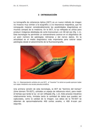 Dr. G. Vincent P. Cedilás Oftalmología
3
I - INTRODUCCIÓN
La tomografía de coherencia óptica (OCT) es un nuevo método de imagen
no invasivo muy similar a la ecografía y a la resonancia magnética, que ha
conseguido mejorar considerablemente las posibilidades diagnósticas en
muchos campos de la medicina. En la OCT, la luz reflejada se utiliza para
producir imágenes detalladas de corte transversal y en 3D del ojo (fig. 1.1).
Esta tecnología ha permitido un extraordinario avance en el diagnóstico de
un gran número de patologías retinianas y del nervio óptico. En la
actualidad es el medio diagnóstico más importante para valorar estas
patologías desde el advenimiento de la fluoresceingrafía.
Fig. 1.1. Representación artística de una OCT, al “levantar” la retina se puede apreciar todas
sus capas mediante una escala pseudocromática.
Una primera versión de esta tecnología, la OCT de “dominio del tiempo”
(time domain TD-OCT), utilizaba un espejo de referencia móvil, para medir
el tiempo que tarda la luz en ser reflejada (fig. 1.2). Este proceso mecánico
relativamente lento, limitaba tanto la cantidad de datos que pueden ser
capturados, como la calidad de la imagen. Los datos de la TD-OCT se
obtenían de aproximadamente 400 cortes axiales, o 400 A-scan por
segundo.
 