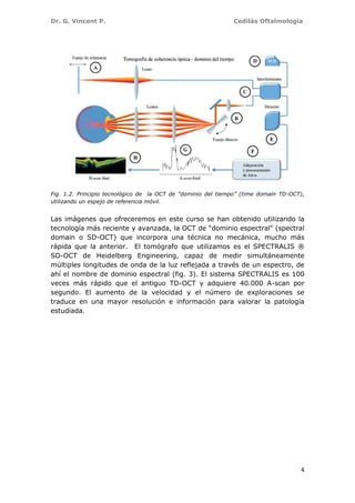 Dr. G. Vincent P. Cedilás Oftalmología
4
Fig. 1.2. Principio tecnológico de la OCT de “dominio del tiempo” (time domain TD-OCT),
utilizando un espejo de referencia móvil.
Las imágenes que ofreceremos en este curso se han obtenido utilizando la
tecnología más reciente y avanzada, la OCT de “dominio espectral" (spectral
domain o SD-OCT) que incorpora una técnica no mecánica, mucho más
rápida que la anterior. El tomógrafo que utilizamos es el SPECTRALIS ®
SD-OCT de Heidelberg Engineering, capaz de medir simultáneamente
múltiples longitudes de onda de la luz reflejada a través de un espectro, de
ahí el nombre de dominio espectral (fig. 3). El sistema SPECTRALIS es 100
veces más rápido que el antiguo TD-OCT y adquiere 40.000 A-scan por
segundo. El aumento de la velocidad y el número de exploraciones se
traduce en una mayor resolución e información para valorar la patología
estudiada.
 