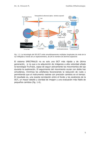 Dr. G. Vincent P. Cedilás Oftalmología
5
Fig. 1.3. La tecnología del SD-OCT mide simultáneamente múltiples longitudes de onda de la
luz reflejada a través de un espectrómetro, de ahí el nombre de dominio espectral.
El sistema SPECTRALIS no es solo una OCT más rápida y de última
generación, si no que a la adquisición de imágenes a alta velocidad añade
la tecnología TruTrack, capaz de seguir activamente los movimientos del ojo
durante la exploración. El seguimiento del movimiento ocular con doble haz
simultáneo, minimiza los artefactos favoreciendo la reducción de ruido y
permitiendo que el instrumento rastree con precisión cambios en el tiempo.
El resultado es, una exacta correlación entre el fondo y los escáneres de la
OCT, un mayor detalle y claridad de imagen y una evaluación más fiable de
pequeños cambios (fig. 1.4).
 