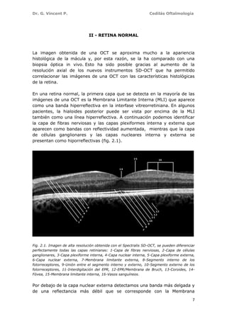 Dr. G. Vincent P. Cedilás Oftalmología
7
II - RETINA NORMAL
La imagen obtenida de una OCT se aproxima mucho a la apariencia
histológica de la mácula y, por esta razón, se la ha comparado con una
biopsia óptica in vivo. Esto ha sido posible gracias al aumento de la
resolución axial de los nuevos instrumentos SD-OCT que ha permitido
correlacionar las imágenes de una OCT con las características histológicas
de la retina.
En una retina normal, la primera capa que se detecta en la mayoría de las
imágenes de una OCT es la Membrana Limitante Interna (MLI) que aparece
como una banda hiperreflectiva en la interfase vitreorretiniana. En algunos
pacientes, la hialoides posterior puede ser vista por encima de la MLI
también como una línea hiperreflectiva. A continuación podemos identificar
la capa de fibras nerviosas y las capas plexiformes interna y externa que
aparecen como bandas con reflectividad aumentada, mientras que la capa
de células ganglionares y las capas nucleares interna y externa se
presentan como hiporreflectivas (fig. 2.1).
Fig. 2.1. Imagen de alta resolución obtenida con el Spectralis SD-OCT, se pueden diferenciar
perfectamente todas las capas retinianas: 1-Capa de fibras nerviosas, 2-Capa de células
ganglionares, 3-Capa plexiforme interna, 4-Capa nuclear interna, 5-Capa plexiforme externa,
6-Capa nuclear externa, 7-Membrana limitante externa, 8-Segmento interno de los
fotorreceptores, 9-Unión entre el segmento interno y externo, 10-Segmento externo de los
fotorreceptores, 11-Interdigitación del EPR, 12-EPR/Membrana de Bruch, 13-Coroides, 14-
Fóvea, 15-Membrana limitante interna, 16-Vasos sanguíneos.
Por debajo de la capa nuclear externa detectamos una banda más delgada y
de una reflectancia más débil que se corresponde con la Membrana
 