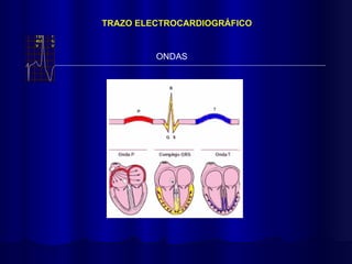 TRAZO ELECTROCARDIOGRÁFICO
ONDAS
 
