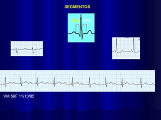 SEGMENTOS
VM 56F 11/10/05
STs
PRs
 