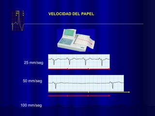 VELOCIDAD DEL PAPEL
25 mm/seg
50 mm/seg
100 mm/seg
 