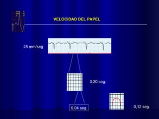 VELOCIDAD DEL PAPEL
25 mm/seg
0,04 seg
0,20 seg.
0,12 seg.
 