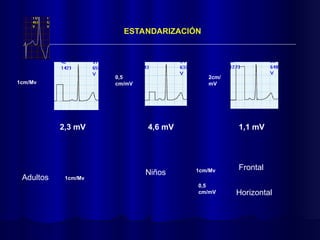 ESTANDARIZACIÓN
1cm/Mv
0,5
cm/mV
2cm/
mV
2,3 mV 4,6 mV 1,1 mV
Adultos 1cm/Mv
Niños 1cm/Mv
0,5
cm/mV
Frontal
Horizontal
 