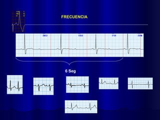 6 Seg
FRECUENCIA
 
