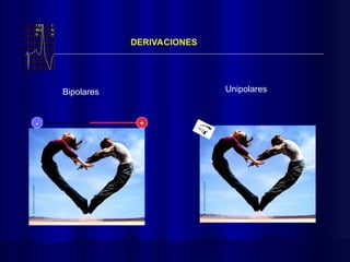 DERIVACIONES
Unipolares
Bipolares
+
-
 