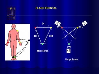 DI
DII DIII
PLANO FRONTAL
-
+
+
-
+
- aVR aVL
aVF
Bipolares
Unipolares
 