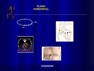 V1
V6
PLANO
HORIZONTAL
Unipolares
 