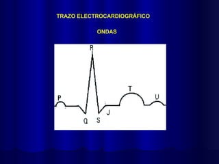 TRAZO ELECTROCARDIOGRÁFICO
ONDAS
 