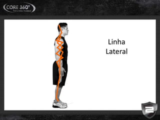 Linha
Lateral
 