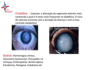 Cristalino : Catarata a alteração do segmento anterior mais
conhecida a qual é 4 vezes mais frequente no diabético. O risco
de catarata aumenta com a duração da doença e com o mau
controlo metabólico

Outras: Hemorragias vítreas,
Glaucoma neovascular ,Flutuações na
refraçao, Embriopatías: Atrofia óptica,
Estrabismo, Nistagmo, Coloboma.etc

 