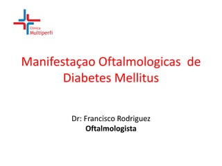 Manifestaçao Oftalmologicas de
Diabetes Mellitus
Dr: Francisco Rodriguez
Oftalmologista

 