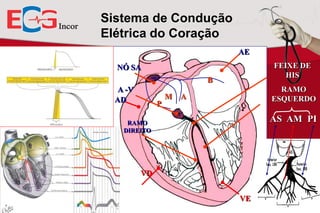 Sistema de Condução
Elétrica do Coração
AE
FEIXE DE
HIS

NÓ SA
B
A -V
AD

P

M

RAMO
ESQUERDO

A

AS AM PI

RAMO
DIREITO

VD
VE

 