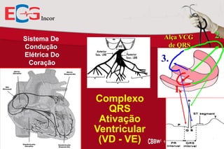 Alça VCG
de QRS

Sistema De
Condução
Elétrica Do
Coração

3.
1.
Complexo
QRS
Ativação
Ventricular
(VD - VE)

2.

 