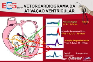 VETORCARDIOGRAMA DA
ATIVAÇÃO VENTRICULAR
Ativação Septal
F e D, 0- 20 ms

Vetor 1;

Ativação das paredes livres
Vetor 2; B, T, E 40-60 ms

3
Ativação das porções basais
Vetor 3; T,D,C 80 -100 ms

2
1

Onda T
Ventricular

Recuperação

 