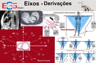 Eixos - Derivações
Plano Frontal

S
Plano Horizontal

-90º

-120º
-120º
aVR

-

-

-60º

+

-

-30º

-150º

D

aVL

D

+

E

DI
0º

-180º
+180º

+
+150º

-

+
+
III
+120º

aVF
+90º

+
II

+30º

+60º

Plano Frontal

 