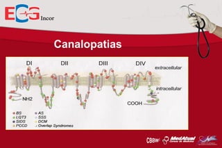 Canalopatias

 