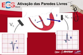 Ativação das Paredes Livres
2
1

R
rr
S

 