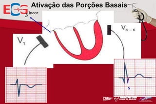 Ativação das Porções Basais
3

S

 
