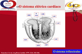 O sistema elétrico cardíaco
RBB

AV
node

LBB
LPF

LAF

LSF

RSF

RMF

Tranchesi J et al. Arq.Bras.Cardiol. 1979: 32/6; 365-360.

RIF

O sistema trifascicular

 