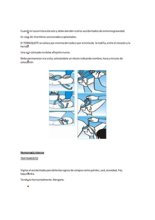 Cuandoel socorristaestásoloy debe atenderaotros accidentadosde extremagravedad.
En caso de miembros seccionadosoaplastados.
El TORNIQUETE se coloca por encimadel codoo por encimade la rodilla,entre el corazónyla
herida.
Una vez colocadonodebe aflojarlonunca.
Debe permanecerala vista,colocándole unrótuloindicandonombre,horayminuto de
colocación.
Hemorragia Interna
TRATAMIENTO
Vigilaral accidentadoparadetectarsignosde colapsocomopalidez,sed,ansiedad,frío,
taquicardia.
Tenderlohorizontalmente.Abrigarlo.
 