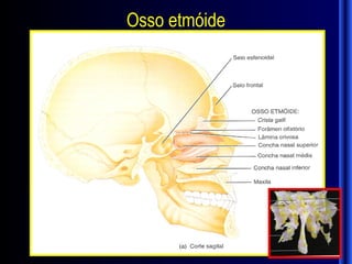 Osso etmóide
 